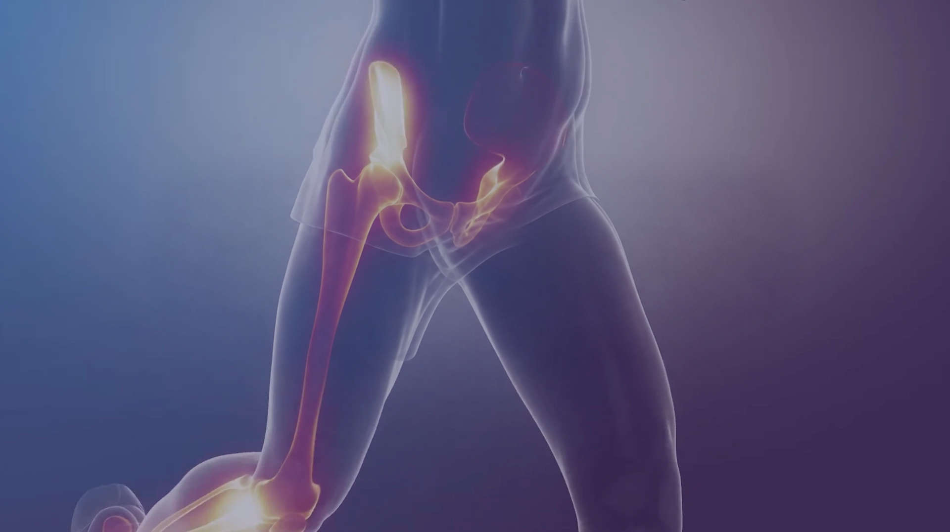 Full lower-body anatomical render showing the hip joint, femoral head and acetabulum, from the original ArtioSense film